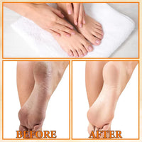 Eelhoe Orange Oil Foot Peeling Spray