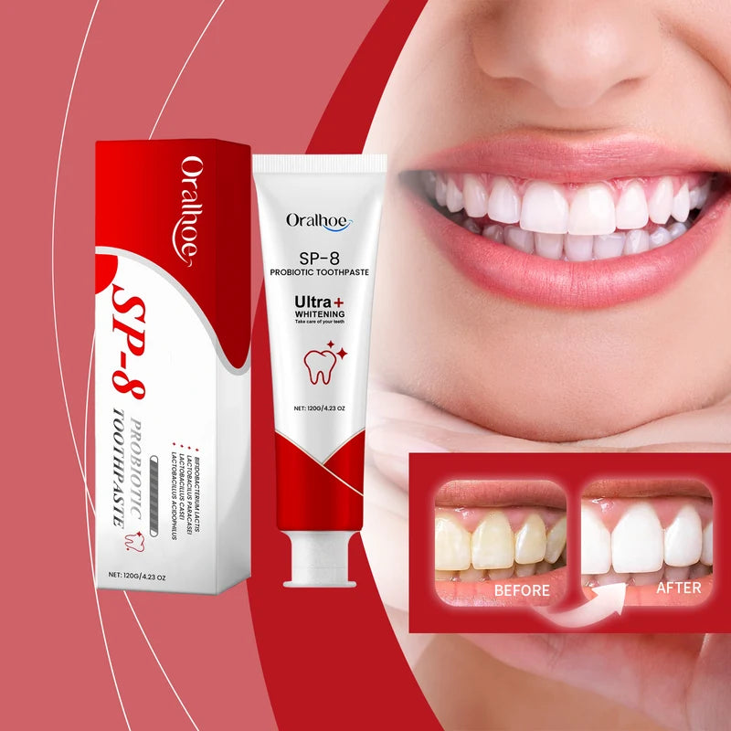 Oralhoe SP-8 Probiotic Whitening Toothpaste