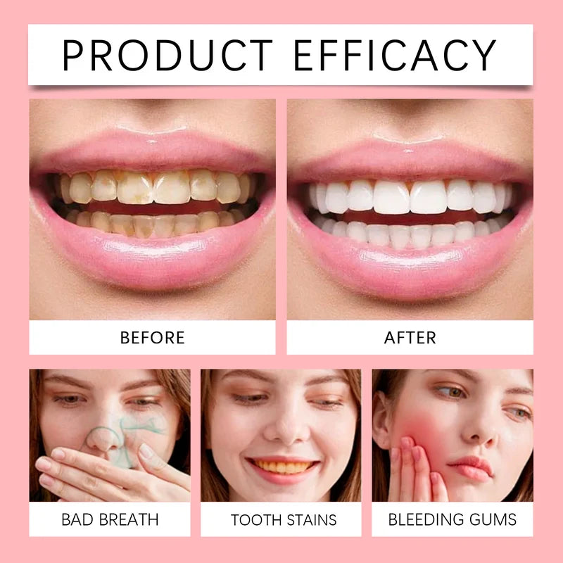 Oralhoe SP-8 Probiotic Whitening Toothpaste